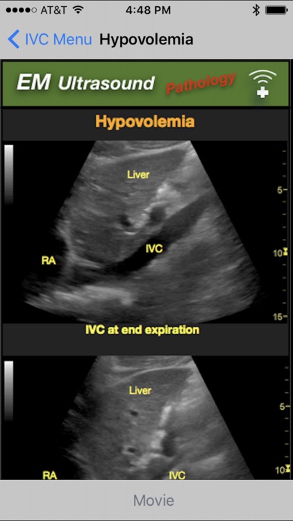 Emergency Medicine Ultrasound screenshot-3