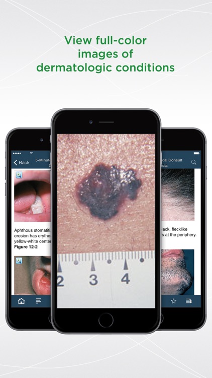 5 Minute Clinical Consult with Bonus Features