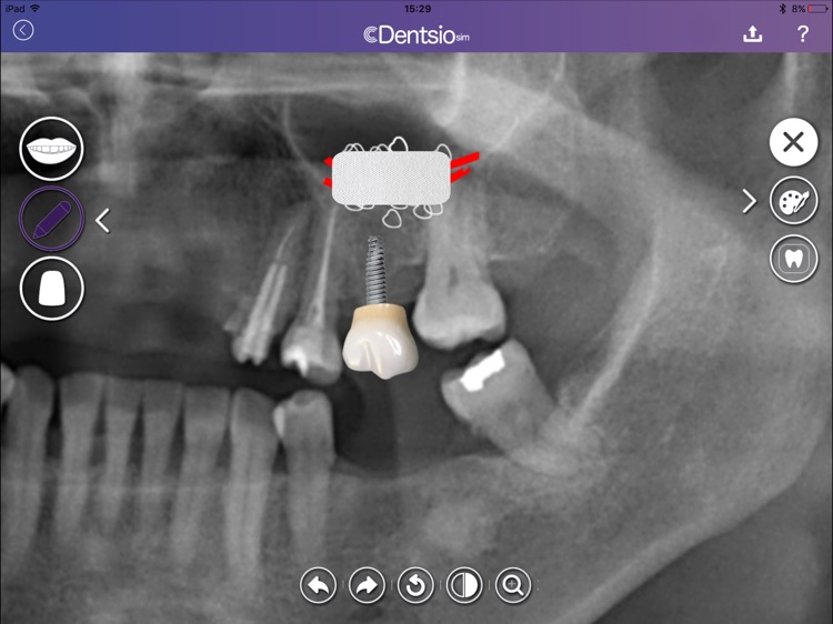 DentsioSim screenshot-3