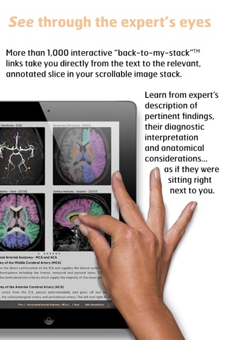 Radiology - Imaging in Stroke screenshot 4