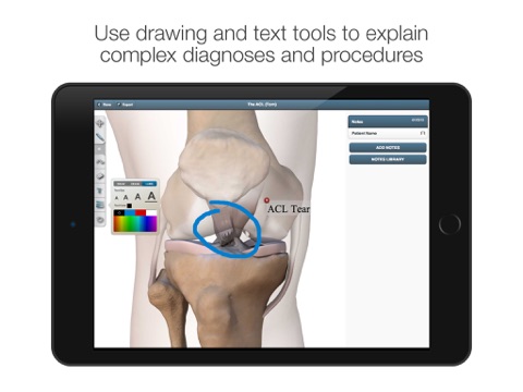 The Visual Consult: ACL Reconstruction screenshot 2
