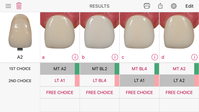 IPS e.max Shade Navigation App(圖4)-速報App