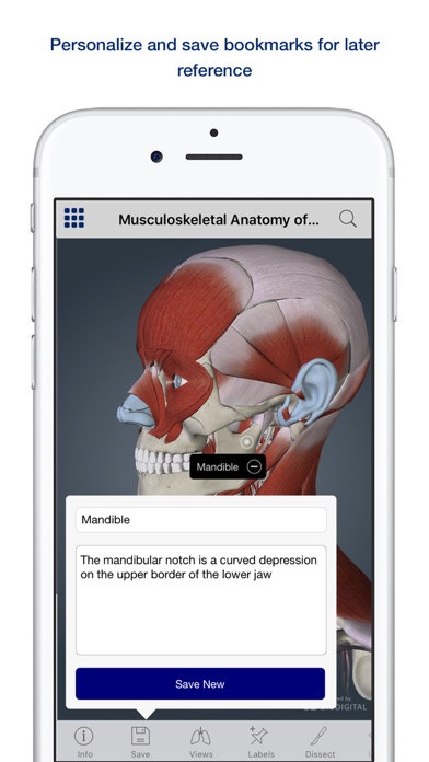 How to cancel & delete 3D Muscle Anatomy from iphone & ipad 4