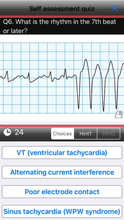 easy ECG training