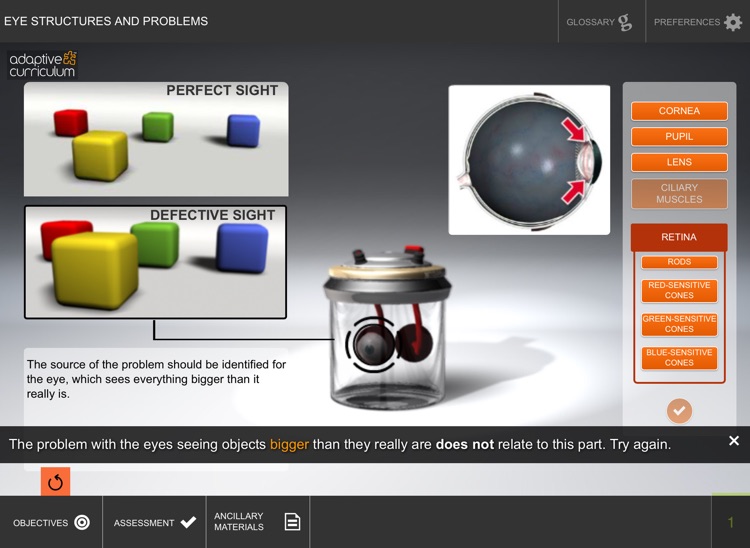 Eye Structures and Problems screenshot-3