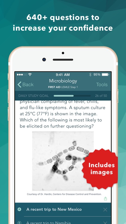 USMLE Step 1 Practice Questions