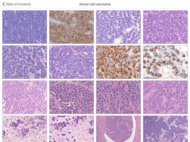 Johns Hopkins Atlas of Pancreatic Pathology(圖2)-速報App