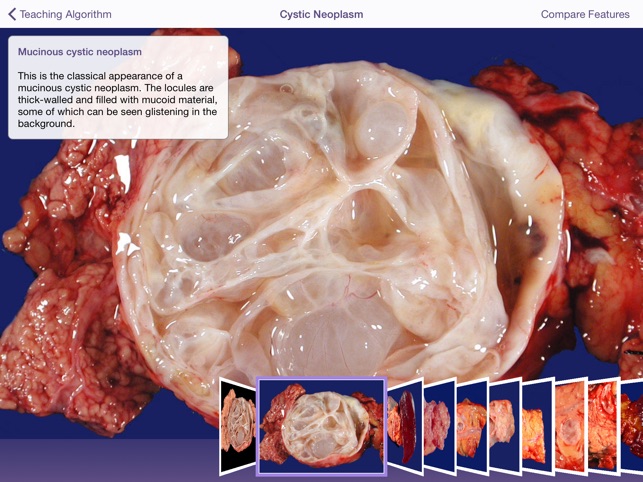 Johns Hopkins Atlas of Pancreatic Pathology(圖3)-速報App