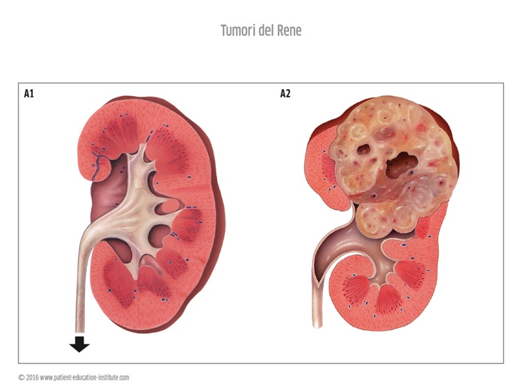 SIU, Urologia, tablet app