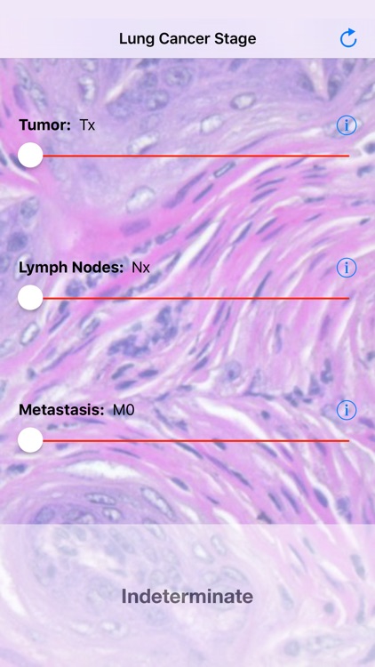 Lung Cancer Stage