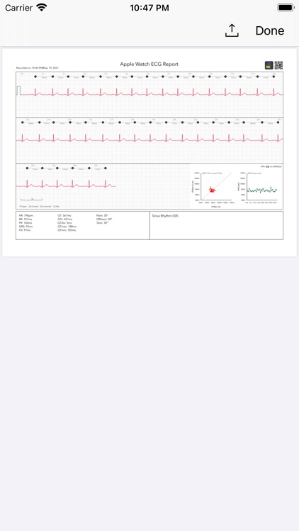 ECG Analyzer for HRV screenshot-7