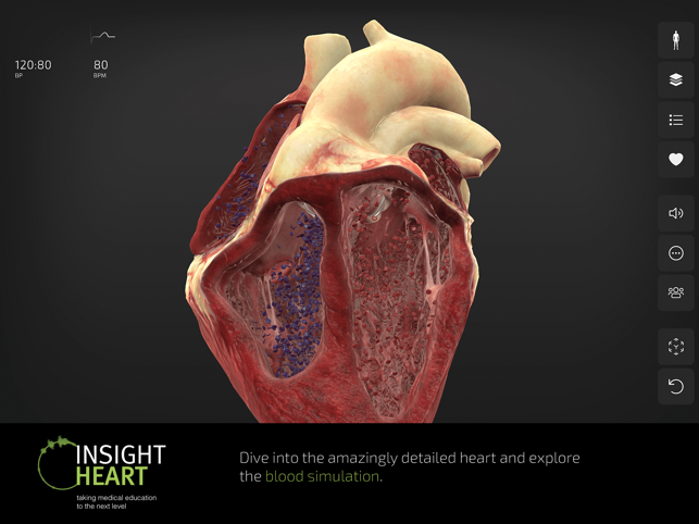 ‎INSIGHT HEART Screenshot