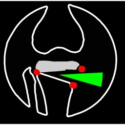 OsteotomyApp