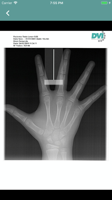 DVI Radiologia Odontológica screenshot 4
