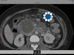 Screenshot 3 IMAIOS Dicom Viewer iphone