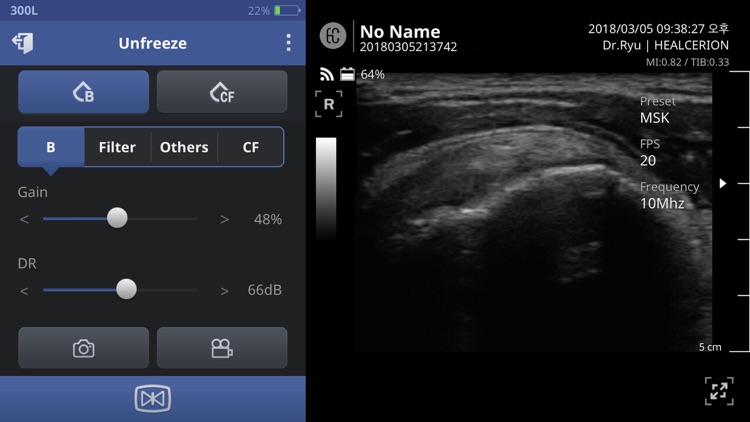 SONON Ultrasound App