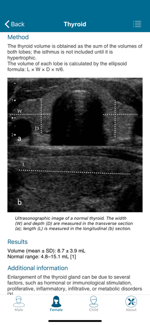 Radiology Measurements(圖4)-速報App