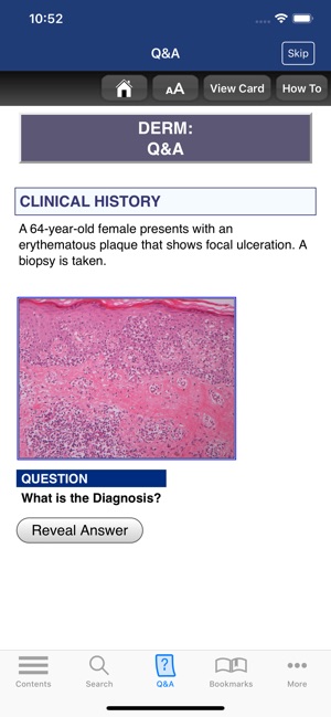 Anatomic Pathology Flashcards(圖4)-速報App