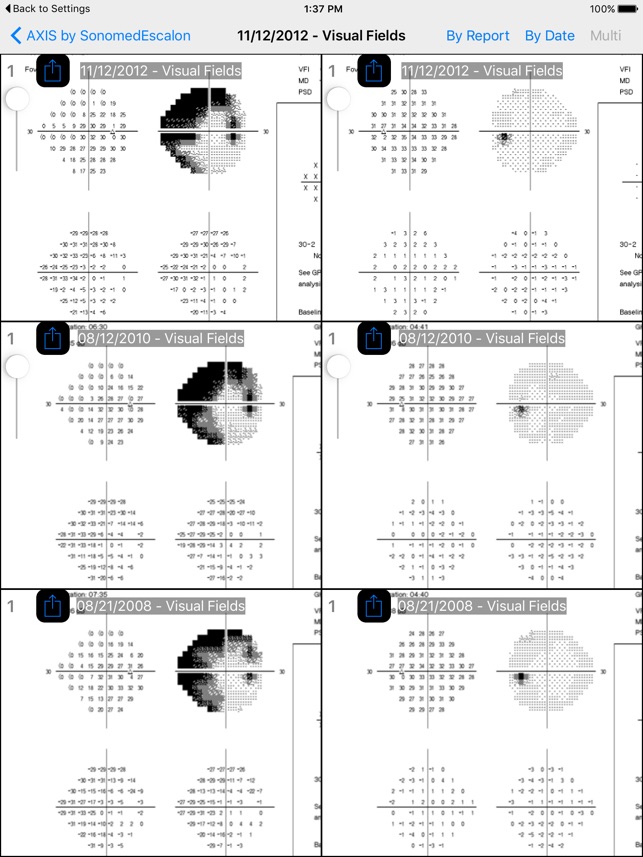 SonomedEscalon Axis(圖5)-速報App