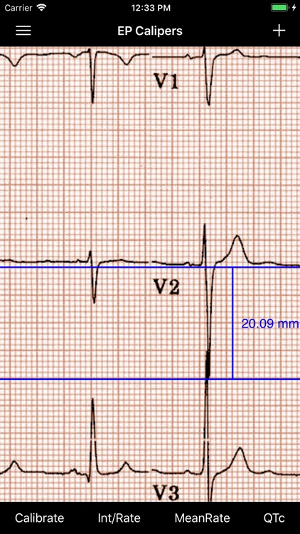 EP Calipers screenshot-5