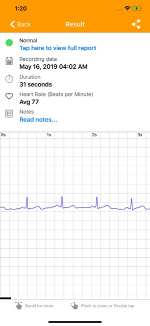 Acutus Medical Q Check(圖3)-速報App