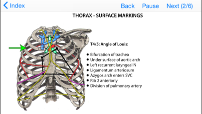 How to cancel & delete Anatomy Topics in Focus from iphone & ipad 2