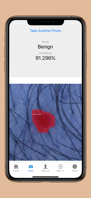 DermoScanner(圖7)-速報App