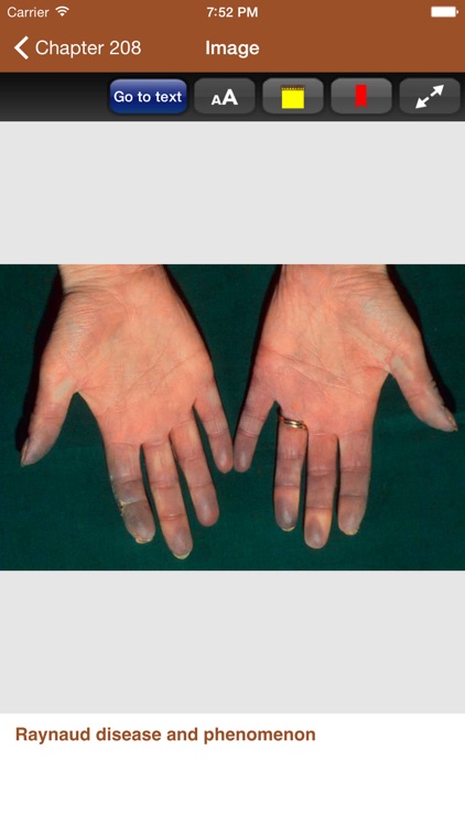 Treatment of Skin Disease, 4/E