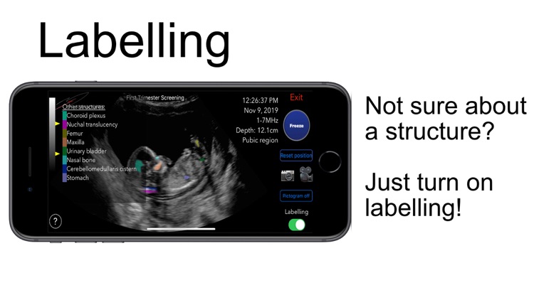 Scanbooster Ultrasound Sim