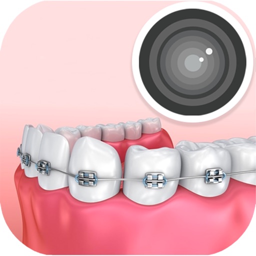 Braces Camera by Youness RAMI