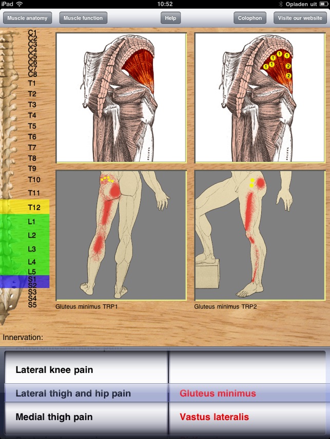 Dry Needling Pro