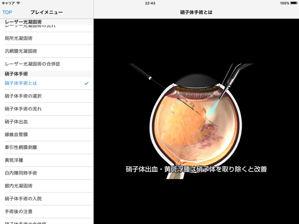 iCeye 糖尿病網膜症 screenshot 2