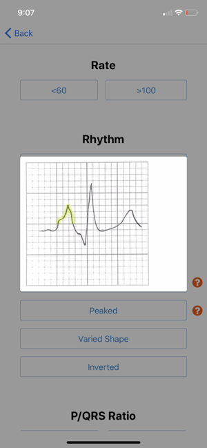 EKG DDX(圖3)-速報App