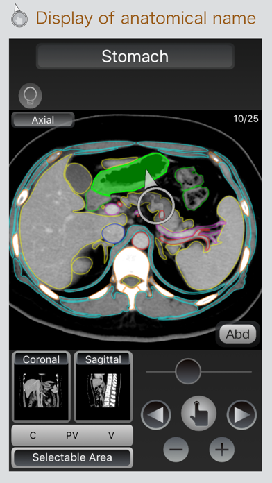 How to cancel & delete CT Passport Abdomen from iphone & ipad 1