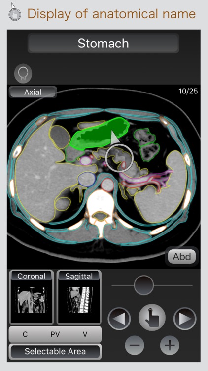 CT Passport Abdomen