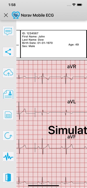 Norav Medical Mobile ECG(圖6)-速報App