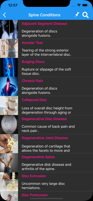 Deuk Spine Institute(圖3)-速報App