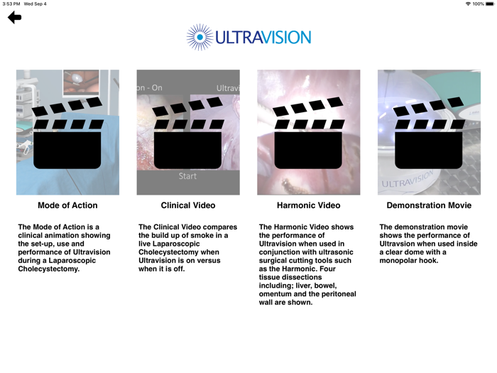 Ultravision