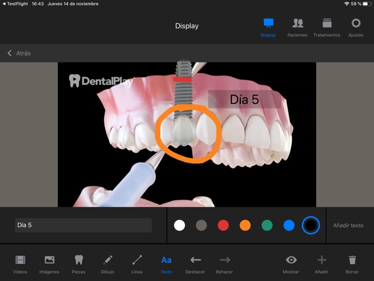 Dentool screenshot-6