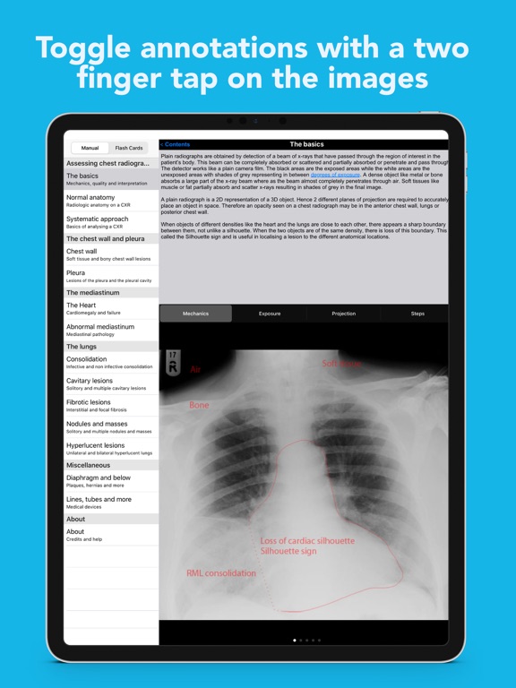 iCXR - Chest xray manual - App voor iPhone, iPad en iPod touch - AppWereld