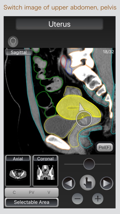 CT Passport Abdomen screenshot-4