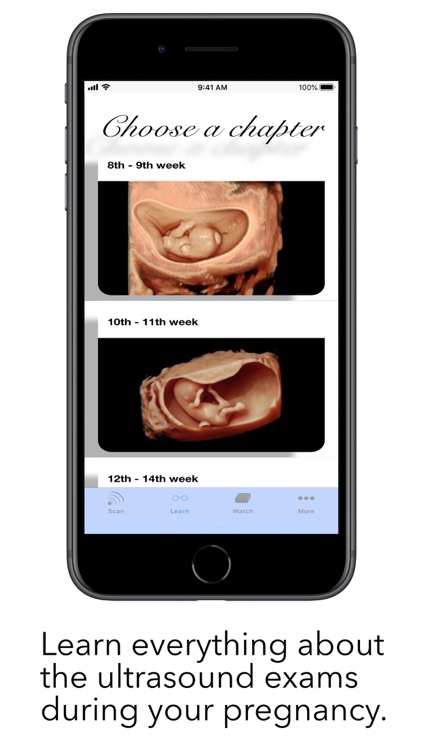 ScanBaby learn baby ultrasound screenshot-5