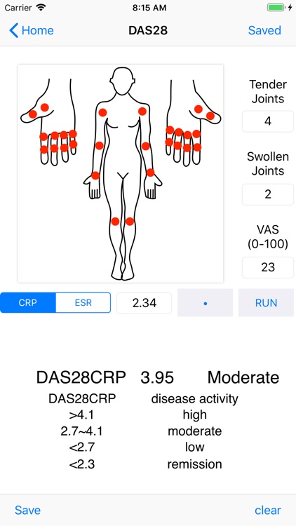 DAS28/ACR-EULAR Criteria By Keiji Matsui