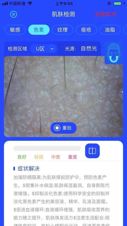 肌肤管家专业版 screenshot-4
