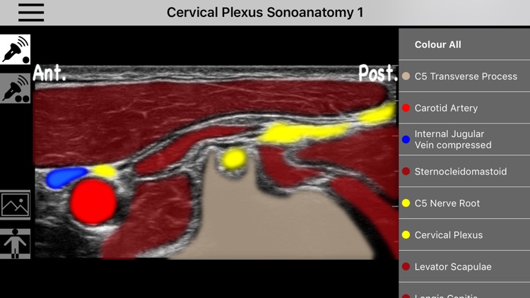 AnSo Anaesthesia Sonoanatomy screenshot-4