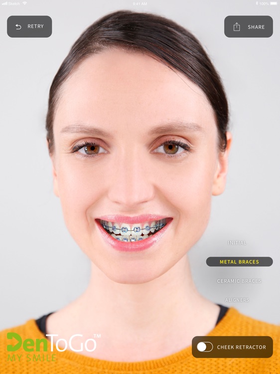 MySmile by Straumann
