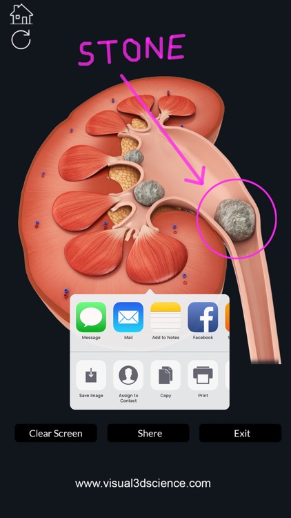 My Kidney Anatomy screenshot-5