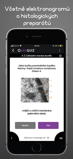 Memorix Histology QUIZ(圖4)-速報App