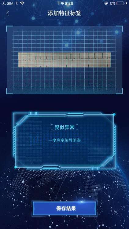 AI识心电 screenshot-4