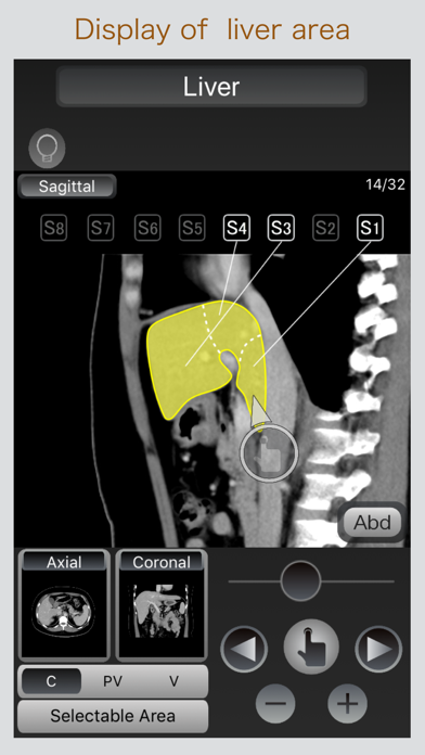 How to cancel & delete CT Passport Abdomen from iphone & ipad 3